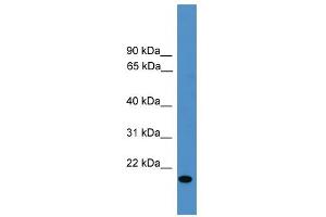 WB Suggested Anti-VEGFB Antibody Titration: 0. (VEGFB antibody  (Middle Region))