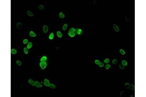 Immunofluorescence (IF) image for anti-Histone Cluster 1, H3a (HIST1H3A) (2meLys9) antibody (ABIN7139282)