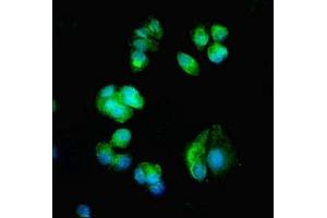 Immunofluorescent analysis of MCF-7 cells using ABIN7175612 at dilution of 1:100 and Alexa Fluor 488-congugated AffiniPure Goat Anti-Rabbit IgG(H+L) (CACNA1H antibody  (AA 260-360))