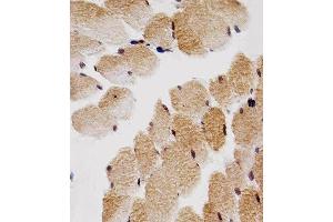 Immunohistochemistry (Paraffin-embedded Sections) (IHC (p)) image for anti-Cyclin-Dependent Kinase Inhibitor 1B (p27, Kip1) (CDKN1B) antibody (ABIN4907895)