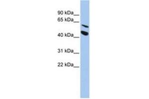Image no. 1 for anti-Matrix Metallopeptidase 24 (Membrane-inserted) (MMP24) (AA 468-517) antibody (ABIN6743434) (MMP24 antibody  (AA 468-517))