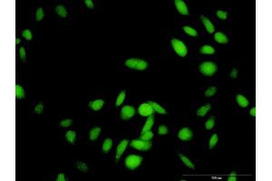 Immunofluorescence of purified MaxPab antibody to RNF25 on HeLa cell. (RNF25 antibody  (AA 1-459))