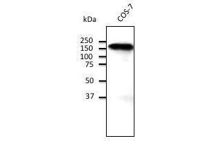Endogenous CD45 detected With ABOIOO at 1/500 dilution, lysate at 100 µg per Iane and rabbit polyclonal to goat lµg (HRP) at 2/10,000 dilution, (E-cadherin antibody)