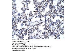 Human Lung (GCM1 antibody  (N-Term))