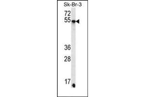 Western blot analysis of SDC3 Antibody (C-term) Cat.