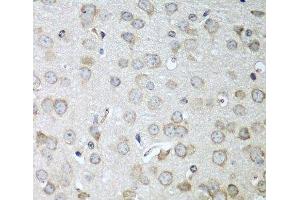 Immunohistochemistry of paraffin-embedded Mouse brain using CDH11 Polyclonal Antibody at dilution of 1:100 (40x lens). (OB Cadherin antibody)
