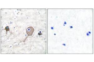 Immunohistochemistry (IHC) image for anti-Enolase 2 (Gamma, Neuronal) (ENO2) (C-Term) antibody (ABIN1848702) (ENO2/NSE antibody  (C-Term))