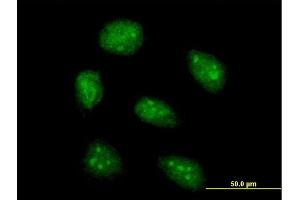 Immunofluorescence of purified MaxPab antibody to AIM2 on HeLa cell. (AIM2 antibody  (AA 1-343))