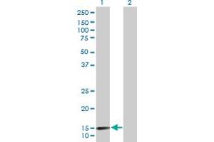 Western Blot analysis of LAMA4 expression in transfected 293T cell line by LAMA4 MaxPab polyclonal antibody. (LAMa4 antibody  (AA 1-120))