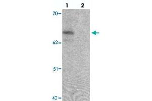 Western blot analysis of ZGPAT in SK-N-SH cell lysate with ZGPAT polyclonal antibody  at 1 ug/mL in (lane 1) the absence and (lane 2) the presence of blocking peptide. (ZGPAT antibody  (C-Term))