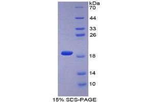 SDS-PAGE (SDS) image for Collagen, Type II, alpha 1 (COL2A1) (AA 677-817) protein (GST-His-Tag) (ABIN2120854)