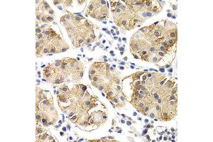 Immunohistochemistry (IHC) image for anti-Chitotriosidase (CHIT1) (AA 217-466) antibody (ABIN3015833) (Chitotriosidase 1 antibody  (AA 217-466))