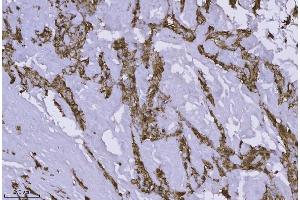 IHC analysis of Annexin-4/ANXA4 using anti-Annexin-4/ANXA4 antibody (ABIN7599265). (Annexin IV antibody  (AA 1-319))
