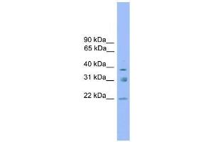 Western Blot showing RNF167 antibody used at a concentration of 1-2 ug/ml to detect its target protein. (RNF167 antibody  (Middle Region))