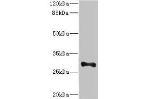 Western blot All lanes: ICAM4 antibody at 4.
