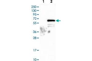 Western blot analysis of Lane 1: Negative control (vector only transfected HEK293T lysate), Lane 2: Over-expression Lysate (Co-expressed with a C-terminal myc-DDK tag (~3. (VIPAR antibody)