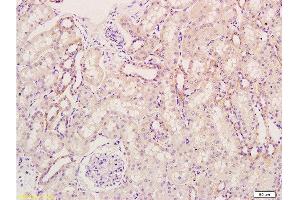 Formalin-fixed and paraffin embedded rat kidney tissue labeled Anti-KGF/FGF7 Polyclonal Antibody, Unconjugated  at 1:300, followed by conjugation to the secondary antibody and DAB staining (FGF7 antibody  (AA 101-194))