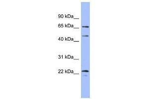 MAPK4 antibody used at 1 ug/ml to detect target protein. (MAPK4 antibody  (Middle Region))
