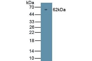 Detection of Recombinant PRKG2, Human using Polyclonal Antibody to Protein Kinase, cGMP Dependent Type II (PRKG2) (PRKG2 antibody  (AA 453-728))