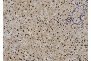ABIN6261667 and ABIN6277489 at 1/100 staining Human liver tissue by IHC-P. (FAM160B2 antibody  (Internal Region))