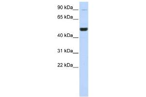 KIF2A antibody used at 1 ug/ml to detect target protein. (KIF2A antibody  (Middle Region))