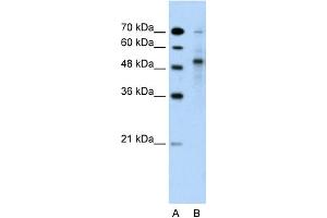 WB Suggested Anti-TRIM59 Antibody Titration:  5.