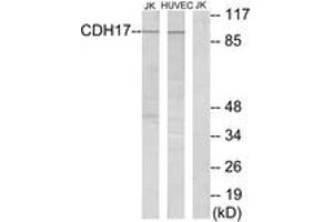 Western Blotting (WB) image for anti-LI Cadherin (AA 341-390) antibody (ABIN2889878) (LI Cadherin antibody  (AA 341-390))