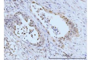 IHC analysis of SBNO1 using anti-SBNO1 antibody (ABIN7601710).