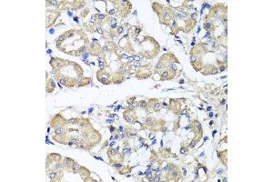 Immunohistochemistry of paraffin-embedded human stomach using BCS1L antibody. (BCS1L antibody  (AA 33-240))