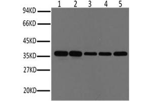 Western Blotting (WB) image for anti-Glyceraldehyde-3-Phosphate Dehydrogenase (GAPDH) antibody (ABIN5959502) (GAPDH antibody)