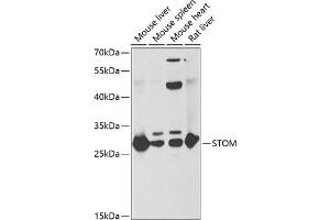 Western blot analysis of extracts of various cell lines, using STOM antibody (ABIN6132877, ABIN6148626, ABIN6148628 and ABIN6221992) at 1:1000 dilution. (Stomatin antibody  (AA 55-288))