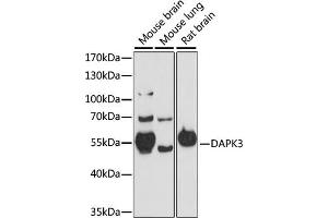 Western blot analysis of extracts of various cell lines, using D antibody (ABIN7266712) at 1:1000 dilution. (DAPK3 antibody  (AA 1-100))