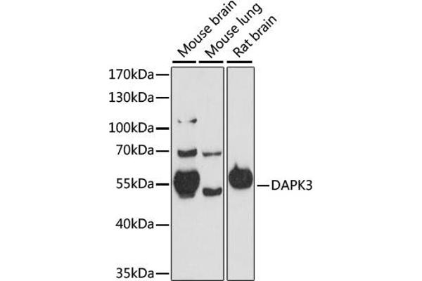 DAPK3 抗体  (AA 1-100)