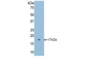 Western blot analysis of recombinant Rat CUBN. (CUBN antibody  (AA 3157-3274))