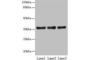 Western blot All lanes: UPP2 antibody at 4 μg/mL Lane 1: Mouse kidney tissue Lane 2: Mouse brain tissue Lane 3: Hela whole cell lysate Secondary Goat polyclonal to rabbit IgG at 1/10000 dilution Predicted band size: 36, 42 kDa Observed band size: 36 kDa (UPP2 antibody  (AA 1-317))