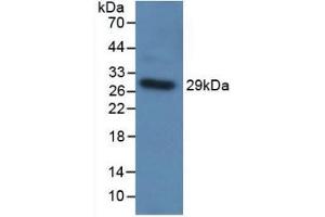 Detection of Recombinant TLR5, Human using Polyclonal Antibody to Toll Like Receptor 5 (TLR5) (TLR5 antibody  (AA 303-514))