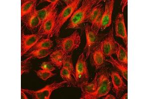IF analysis of ALKBH1 using anti-ALKBH1 antibody (ABIN7602742) and anti-Tubulin Alpha antibody (ABIN7600339). (ALKBH1 antibody  (C-Term))