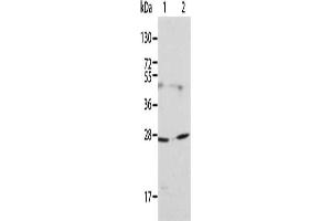 Gel: 12 % SDS-PAGE, Lysate: 40 μg, Lane 1-2: 231 cells, HT29 cells, Primary antibody: ABIN7130018(KLK15 Antibody) at dilution 1/200, Secondary antibody: Goat anti rabbit IgG at 1/8000 dilution, Exposure time: 1 minute (Kallikrein 15 antibody)