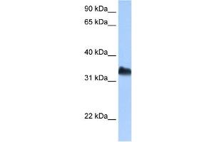 DND1 antibody used at 0.