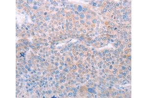 Immunohistochemistry (IHC) image for anti-Spermatogenesis Associated 6 (SPATA6) antibody (ABIN2422311)
