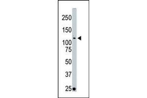 The anti-LOK Pab (ABIN392476 and ABIN2842057) is used in Western blot to detect LOK in Jurkat cell lysate. (STK10-A antibody  (C-Term))