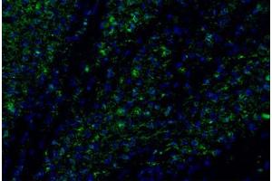 Image no. 2 for anti-Chemokine (C-C Motif) Ligand 2 (CCL2) antibody (ABIN465001) (CCL2 antibody)