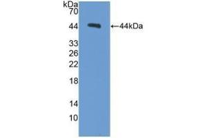 Detection of Recombinant PCT, Mouse using Polyclonal Antibody to Procalcitonin (PCT) (Procalcitonin antibody  (AA 26-136))