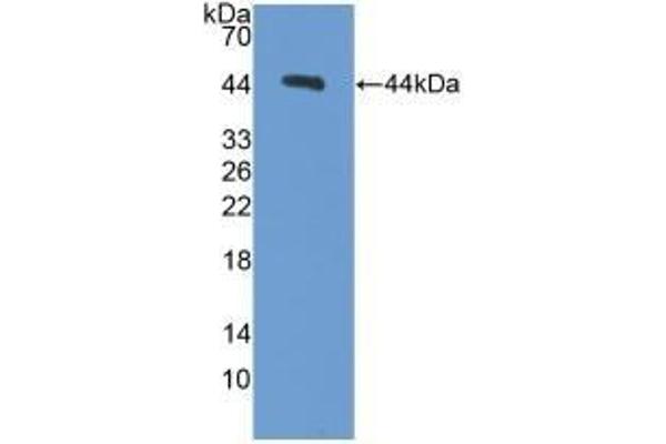Procalcitonin Antikörper  (AA 26-136)