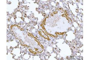 IHC analysis of DTR/HBEGF using anti-DTR/HBEGF antibody (ABIN7603042). (HBEGF antibody  (Middle Region))