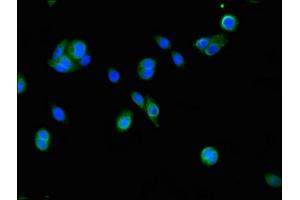 Immunofluorescent analysis of HepG2 cells using ABIN7152911 at dilution of 1:100 and Alexa Fluor 488-congugated AffiniPure Goat Anti-Rabbit IgG(H+L) (FSIP2 antibody  (AA 5530-5824))