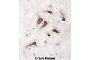 Immunohistochemistry (IHC) image for anti-Calcium/calmodulin-Dependent Protein Kinase II delta (CAMK2D) antibody (ABIN5023065) (CAMK2D antibody)