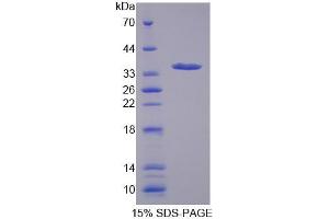 Image no. 1 for Solute Carrier Family 25, Member 37 (SLC25A37) (AA 65-338) protein (His tag) (ABIN6237049)