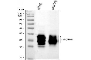 Western blot analysis of SFTPA1/2 using anti-SFTPA1/2 antibody (ABIN3043922). (SFTPA2 antibody  (C-Term))
