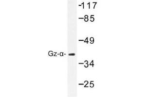 Image no. 1 for anti-Guanine Nucleotide Binding Protein (G Protein), alpha Z Polypeptide (GNaZ) antibody (ABIN317793) (GNaZ antibody)